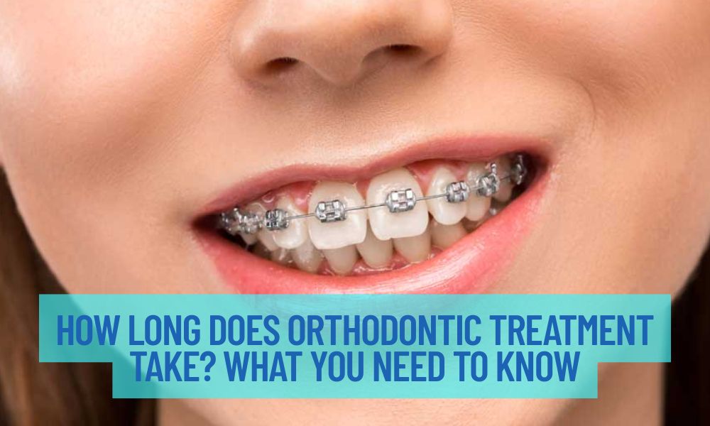 How Long Does Orthodontic Treatment Take? What You Need To Know