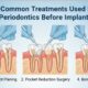 4 Common Treatments Used In Periodontics Before Implants