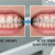 How Periodontal Therapy Prepares Patients For Orthodontics