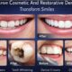 4 Ways Cosmetic And Restorative Dentistry Transform Smiles
