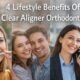 4 Lifestyle Benefits Of Clear Aligner Orthodontics