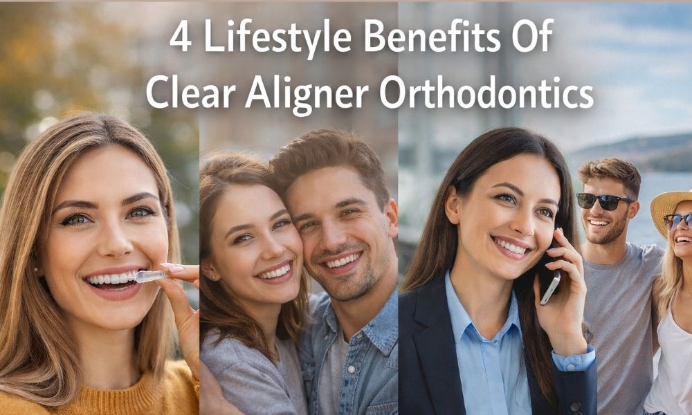 4 Lifestyle Benefits Of Clear Aligner Orthodontics
