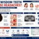 Can Wisdom Teeth Cause Headaches